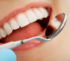 Dental Crowns specialist new hyde park