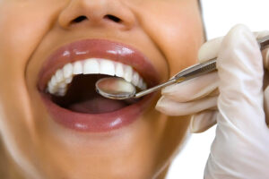 Dental fillings treatment at South Shore Dental