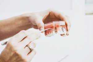 dental bridges vs dental implants