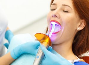 Dental fillings treatment at South Shore Dental